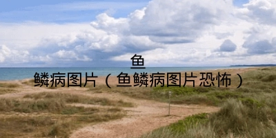 鱼鳞病图片(鱼鳞病图片恐怖)